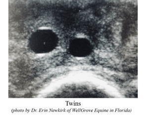 Ultrasound Photo from Newkirk Twins with label border - December 2020
